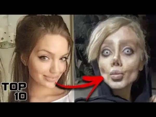 Video: Top 10 INSANE Botched Surgeries